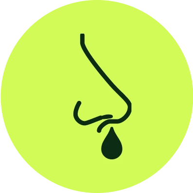 Escurrimiento nasal
