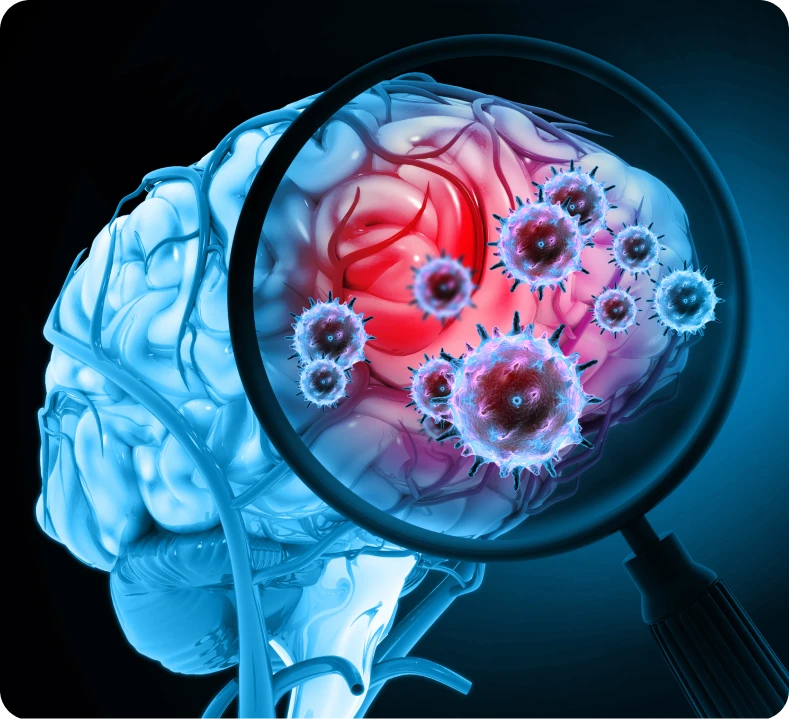 ¿Qué es la meningitis meningocócica?
